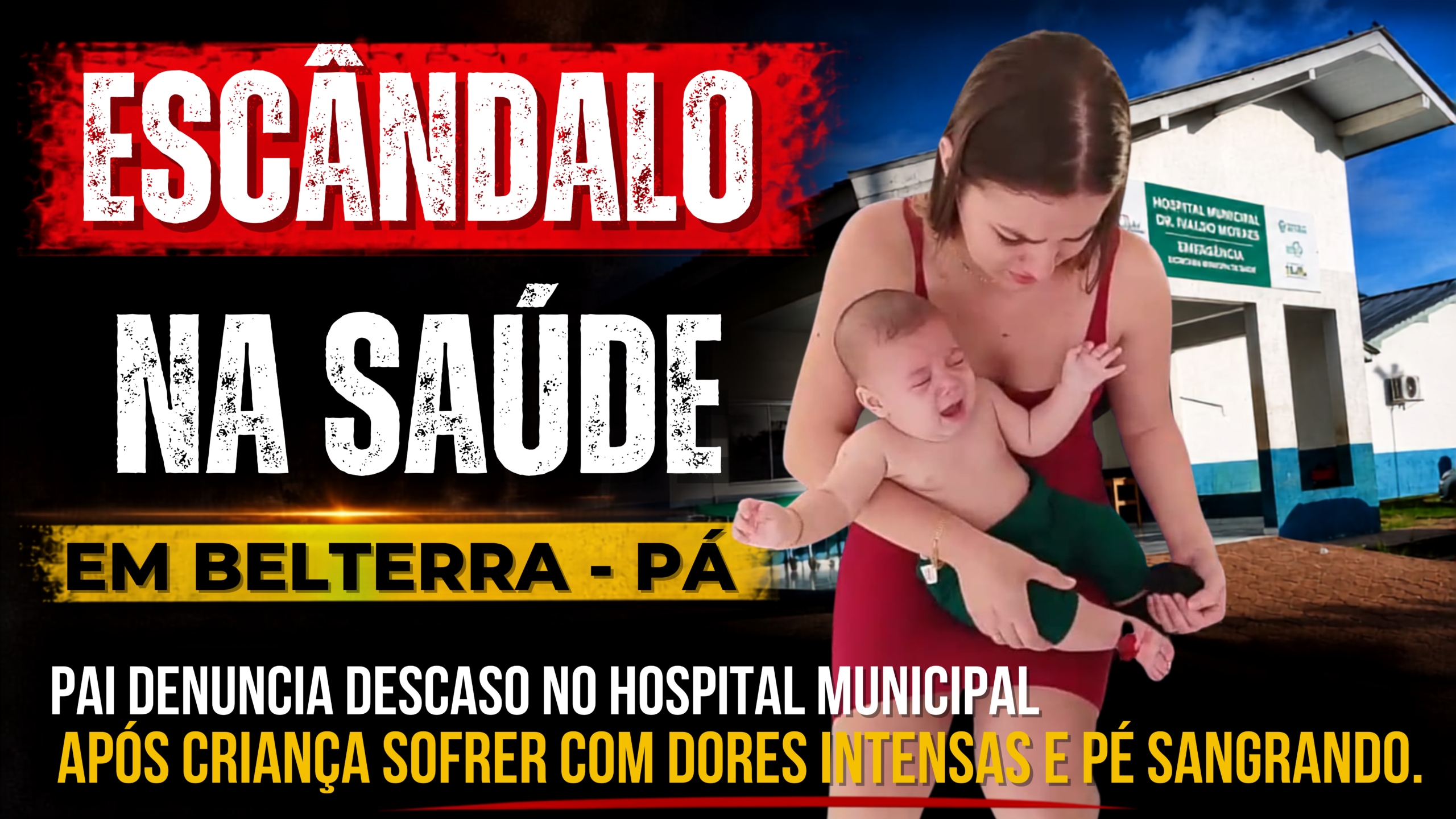 Escândalo na saúde em Belterra – Pá: pai denuncia suposto descaso no Hospital Municipal após criança sofrer com dores intensas e pé sangrando.
